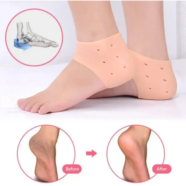 half Heel Pain Anti Crack Silicone Set - Anti Crack  For Pain Relief Unisex - Image 4