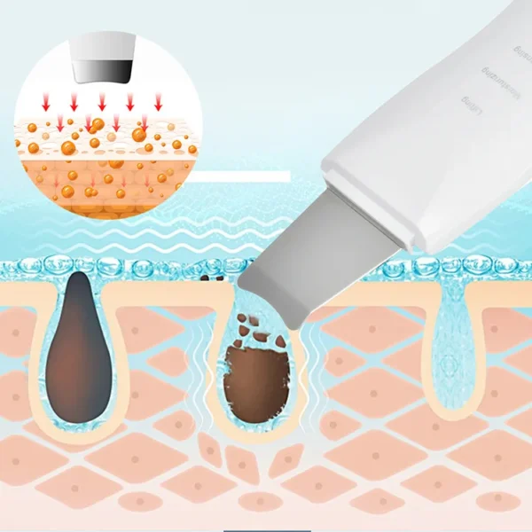 Blackhead Shovel Machine for Facial Skin Scrubber Lifting Moisturizing & Cleansing Skin Dirt Machine | Blackhead Remover Facial Cleansing Tool (White) - Image 16
