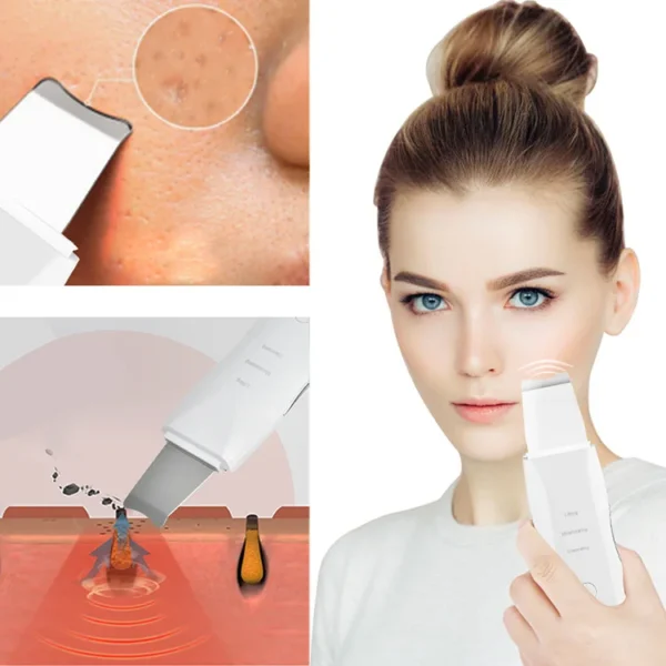 Blackhead Shovel Machine for Facial Skin Scrubber Lifting Moisturizing & Cleansing Skin Dirt Machine | Blackhead Remover Facial Cleansing Tool (White) - Image 17
