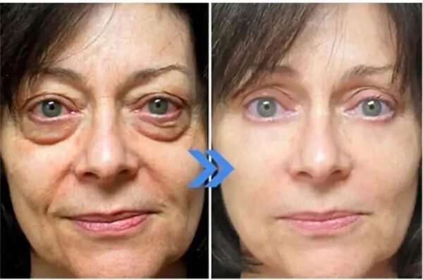 10pcs / 1 Box Eyes Bag Remove Collagen Eye Patch Instant Fade Fine Lines Dark Circles Fat Particles Moisturizing Anti-puffiness Korea Eye Care - Image 14