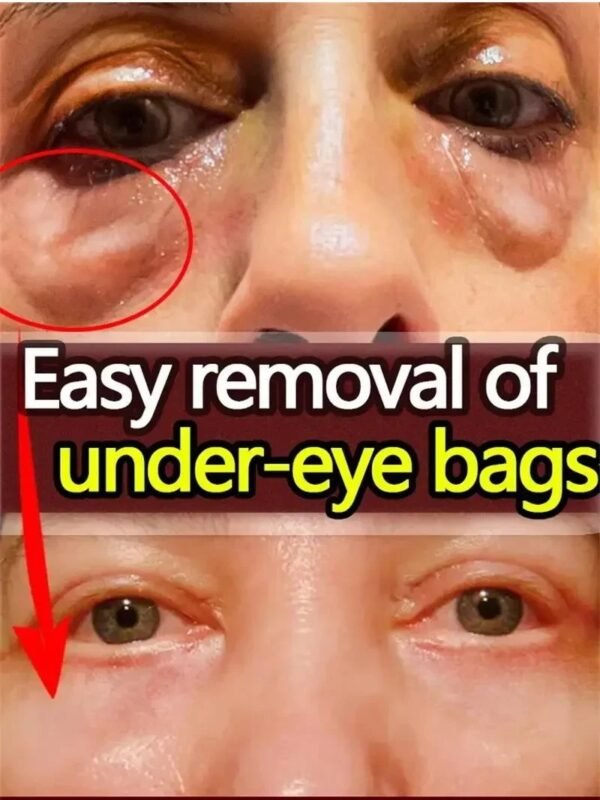 10pcs / 1 Box Eyes Bag Remove Collagen Eye Patch Instant Fade Fine Lines Dark Circles Fat Particles Moisturizing Anti-puffiness Korea Eye Care - Image 15