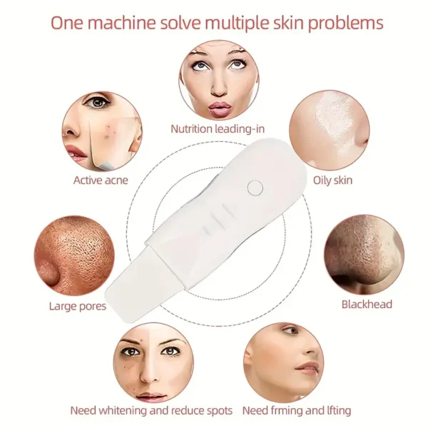 Blackhead Shovel Machine for Facial Skin Scrubber Lifting Moisturizing & Cleansing Skin Dirt Machine | Blackhead Remover Facial Cleansing Tool (White) - Image 15