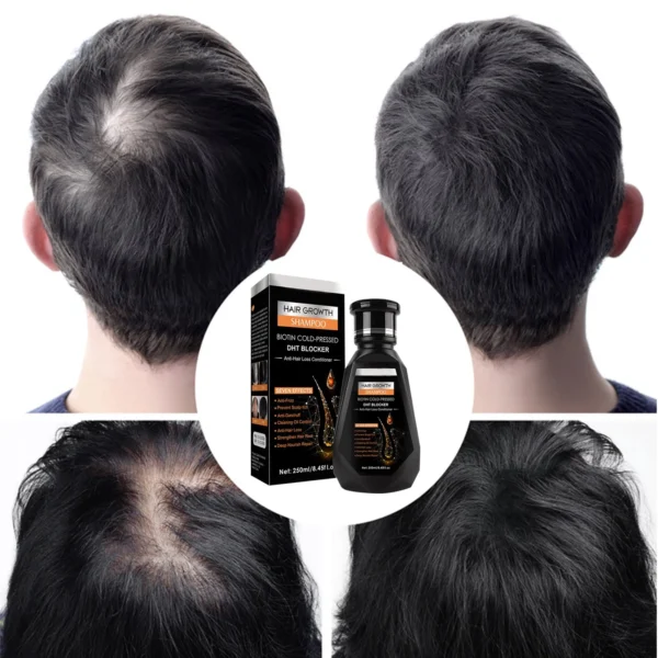 Pei Mei Hair Growth Shampoo | Biotin Cold Pressed Hair SHAMPOO - Image 10