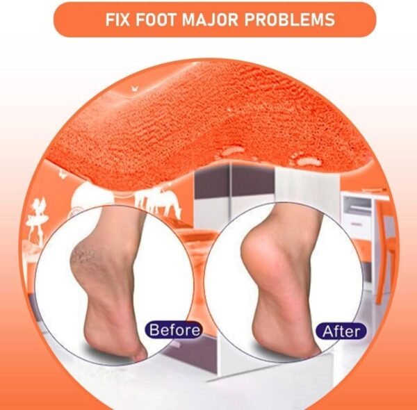 Spa Gel Socks, Ultra Soft Silicone Full Foot/Heel Protection Socks - Image 7