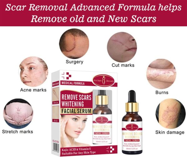 AICHUN BEAUTY Scar Removal Facial Serum Pimples Stretch Marks Face Moisturizing Body Remove Scars Kojic Acid | Vitamin - E | 30ml - Image 7