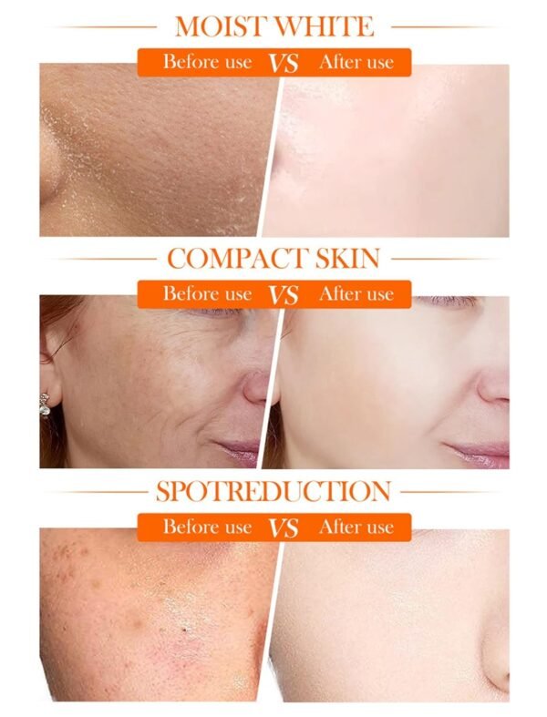 Sadoer 5 Heavy Vitamin C Skin Active whitening Cream | Vitamin C Hydrating Face Cream - Glowing & Repairing Moisturizer for Fine Lines, Wrinkles & Uneven Skin Tone | Whitening Cream - Image 8