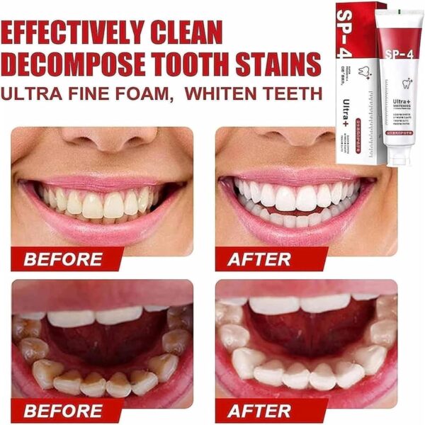 Yayashi  Sp-4 Ultra Whitening Toothpaste Probiotic Stain Remover / Stain Removing Toothpaste, Protects Gums Freshens Breath, for Everyone - Image 2