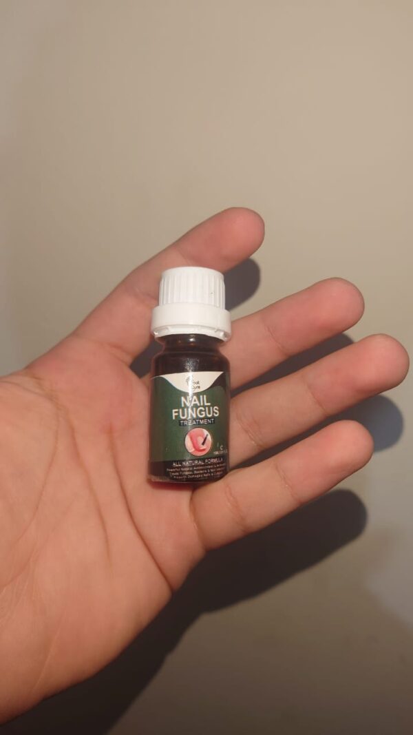Fast Nail Fungal Treatments Nail Repair Essences Serum Care Treatments Foot Nail Fungus Removal Gel (10 ml) - Image 3